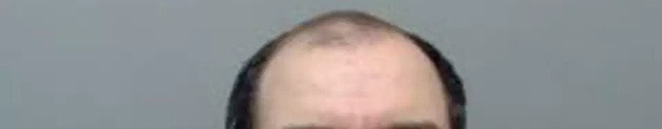 Another Krome-Domed Kik&nbsp;Kreeper